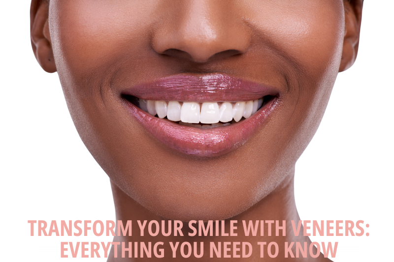Transform-Your-Smile-with-Veneers-Everything-You-Need-to-Know-800x533